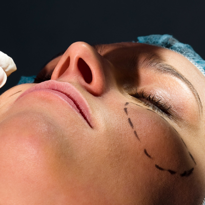 hair transplantation brings out the best in you
