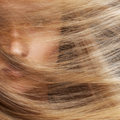 hair characteristics a major consideration in hair transplantation