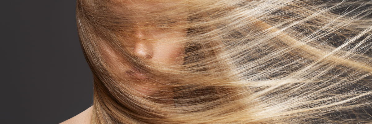 hair characteristics a major consideration in hair transplantation