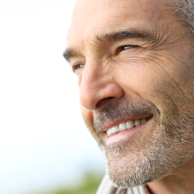 hair transplantation after age 50