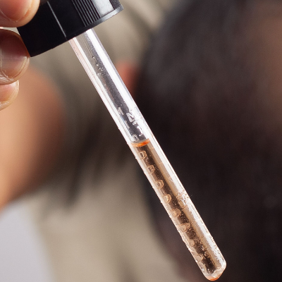 combined surgical and medical hair restoration therapy a comprehensive approach