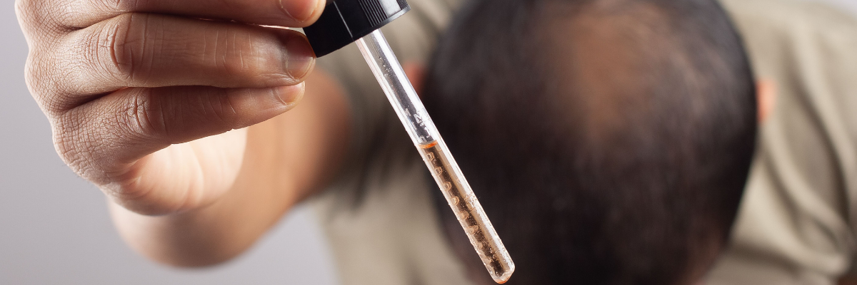 combined surgical and medical hair restoration therapy a comprehensive approach