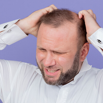 why men are balding at a younger age 1200x400