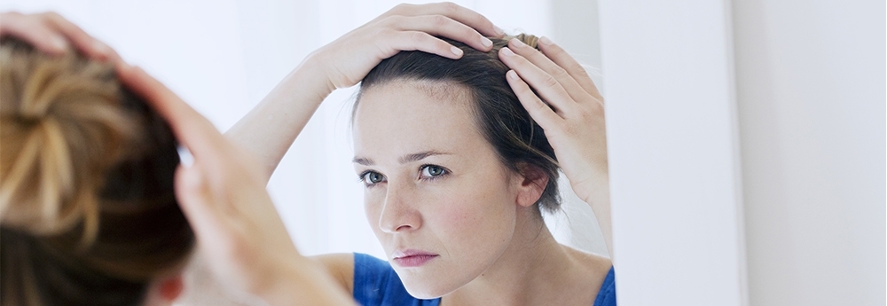 female hair loss