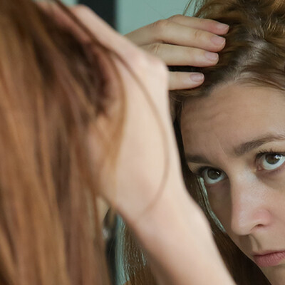 Female Hair Loss