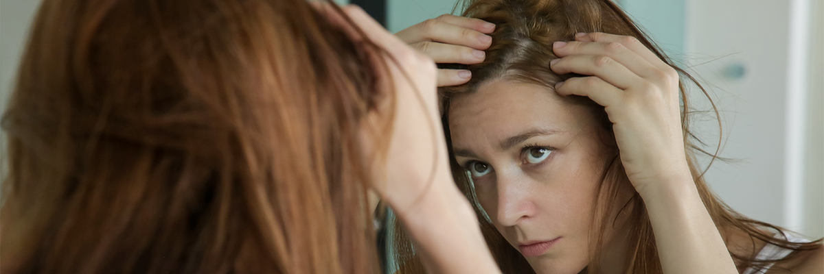 Female Hair Loss