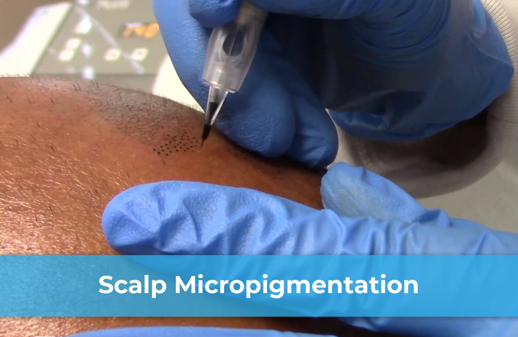 scalp micropigmentation