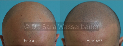shaved look before and after
