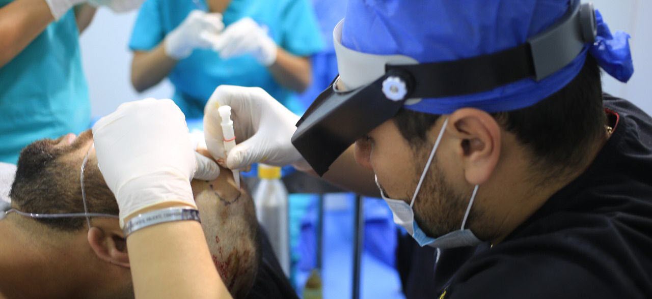 ishrs hair transplant repair day