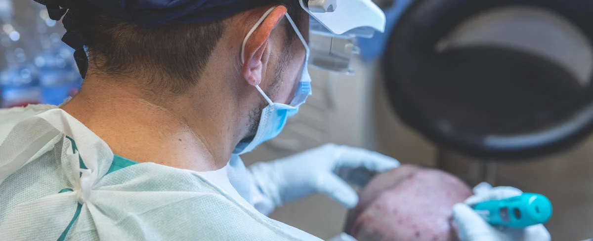 techniques fue hair transplant